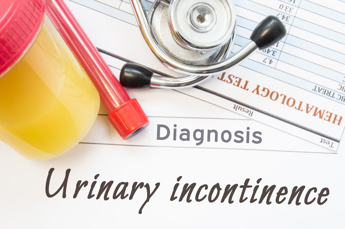 Primary Causes of Urinary Incontinence in Women